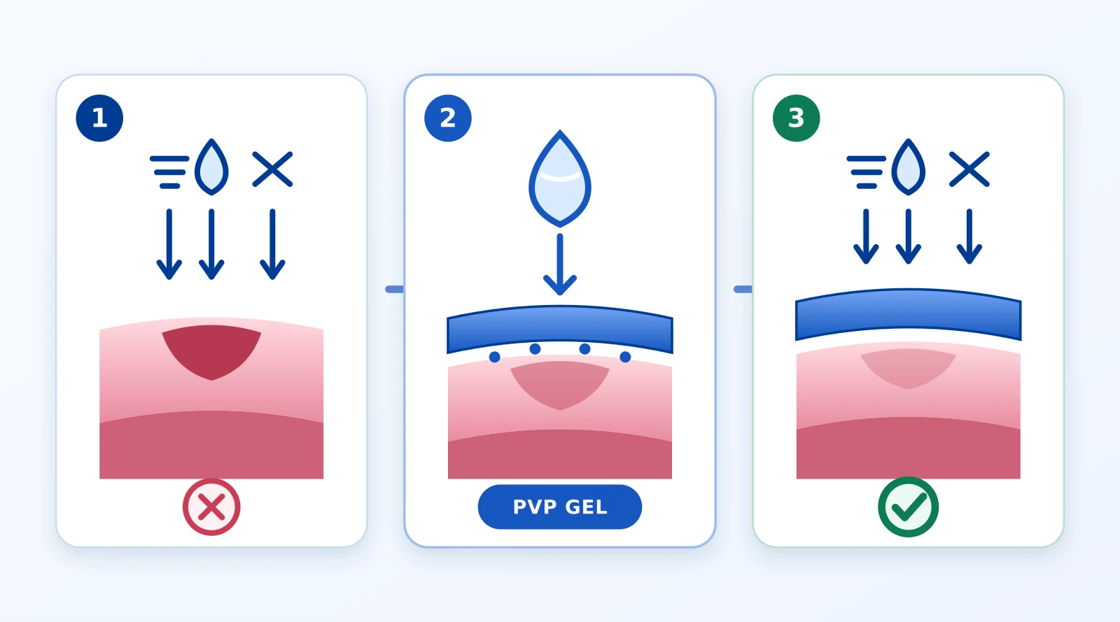 ภาพกลไกสามขั้นของ PVP Gel ตั้งแต่เยื่อบุสัมผัสสิ่งกระตุ้น การเคลือบฟิล์ม ไปจนถึงการลดการสัมผัสโดยตรง